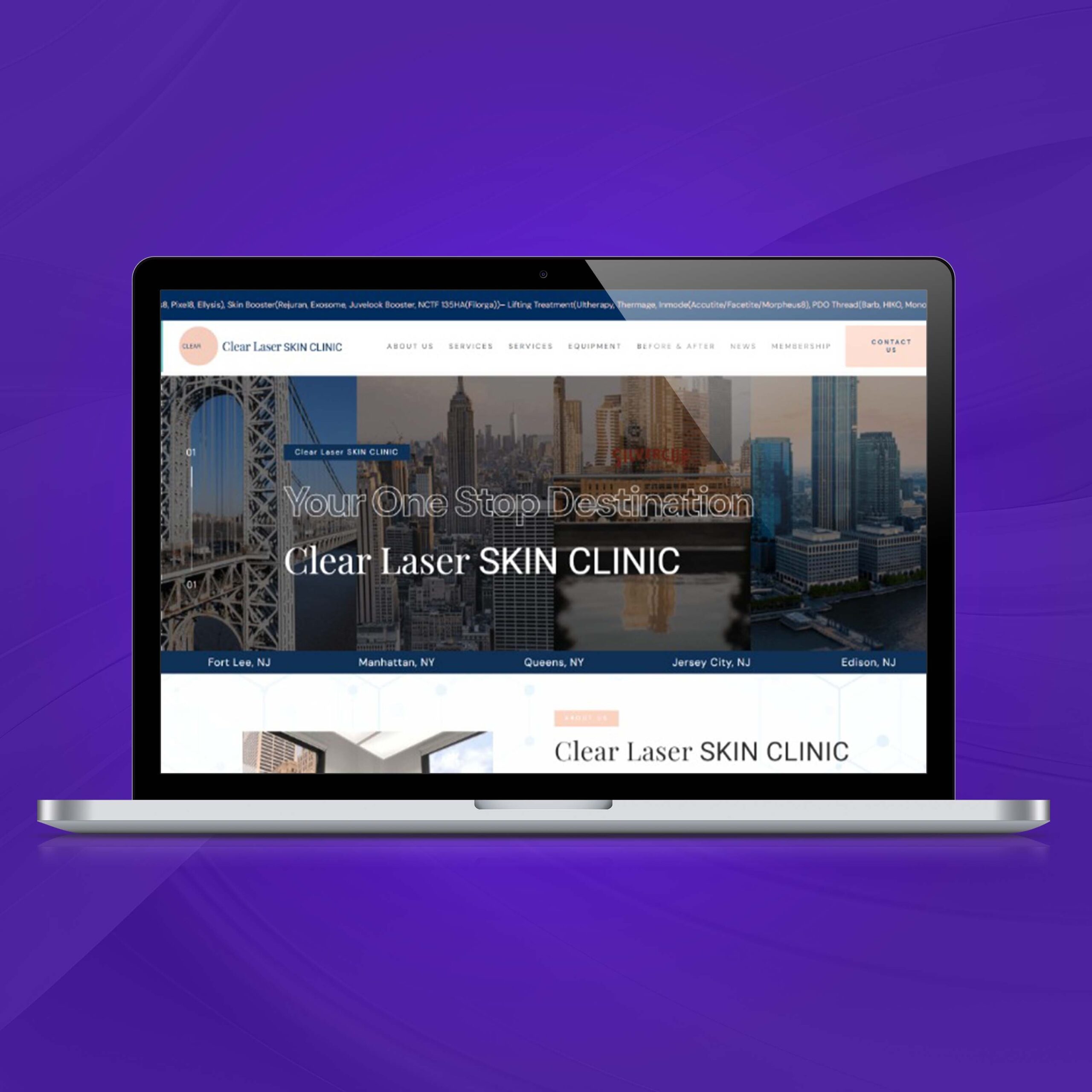 clear laser skin